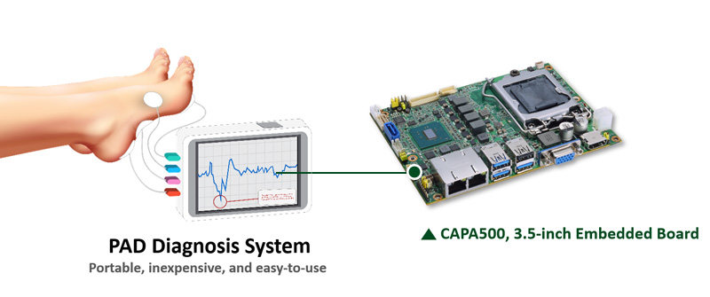 PAD Diagnosis System 